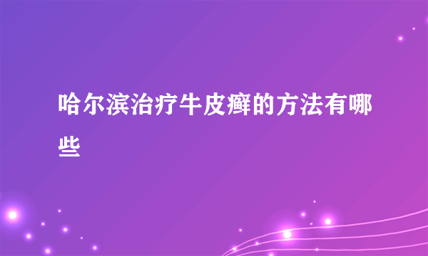 哈尔滨治疗牛皮癣的方法有哪些