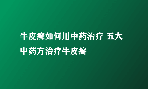 牛皮癣如何用中药治疗 五大中药方治疗牛皮癣