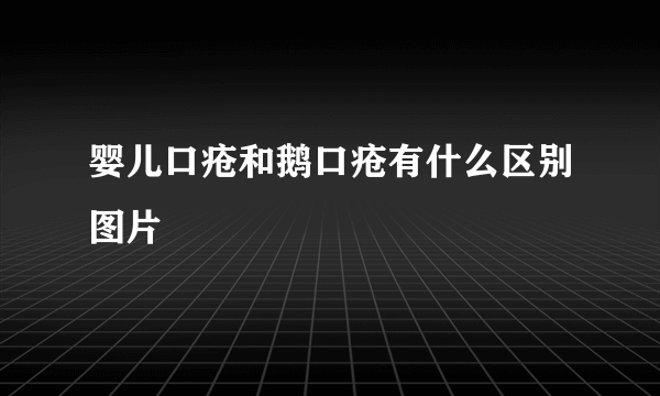 婴儿口疮和鹅口疮有什么区别图片