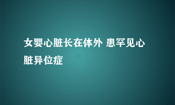 女婴心脏长在体外 患罕见心脏异位症