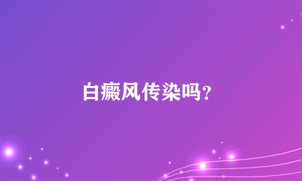 白癜风传染吗？