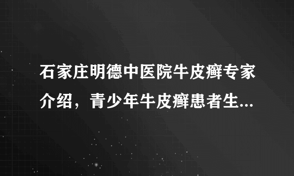 石家庄明德中医院牛皮癣专家介绍，青少年牛皮癣患者生活中要注意什么？