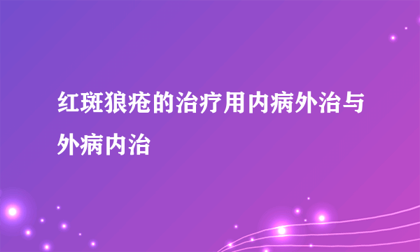 红斑狼疮的治疗用内病外治与外病内治