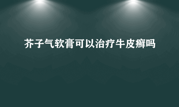 芥子气软膏可以治疗牛皮癣吗