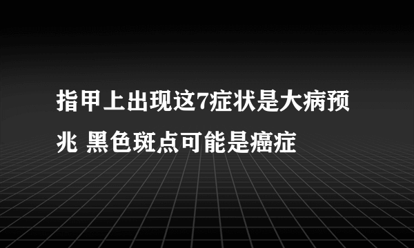 指甲上出现这7症状是大病预兆 黑色斑点可能是癌症