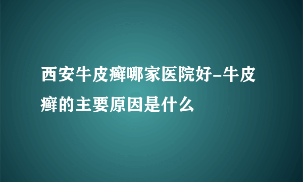 西安牛皮癣哪家医院好-牛皮癣的主要原因是什么