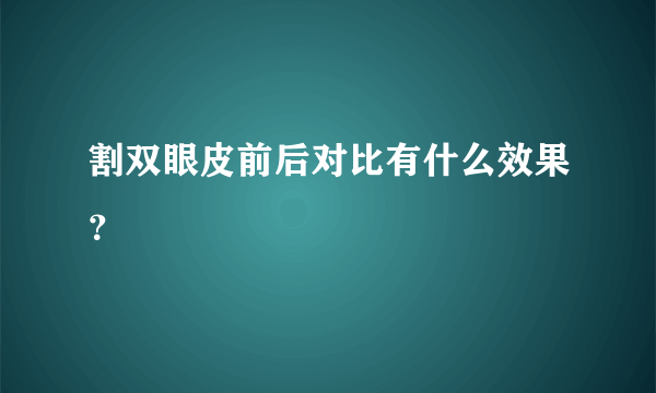 割双眼皮前后对比有什么效果？