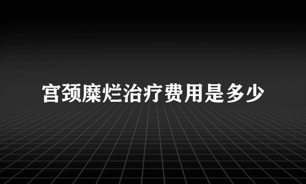 宫颈糜烂治疗费用是多少