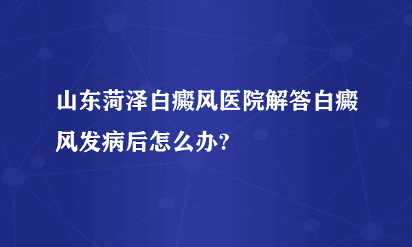 山东菏泽白癜风医院解答白癜风发病后怎么办?