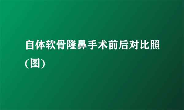 自体软骨隆鼻手术前后对比照(图)