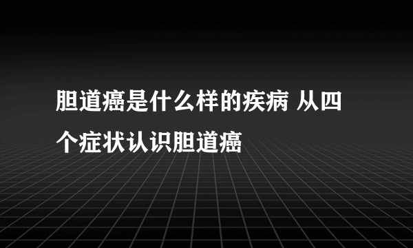 胆道癌是什么样的疾病 从四个症状认识胆道癌