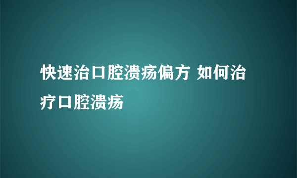 快速治口腔溃疡偏方 如何治疗口腔溃疡