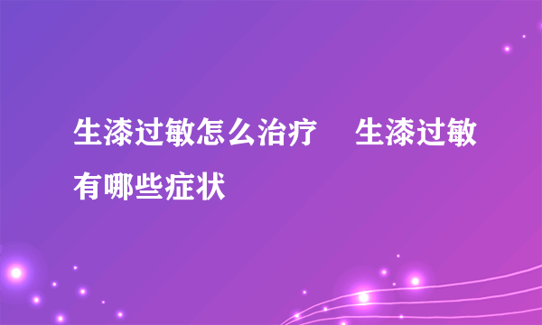 生漆过敏怎么治疗    生漆过敏有哪些症状