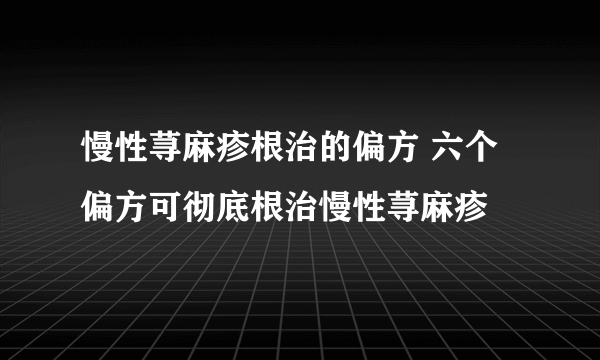 慢性荨麻疹根治的偏方 六个偏方可彻底根治慢性荨麻疹