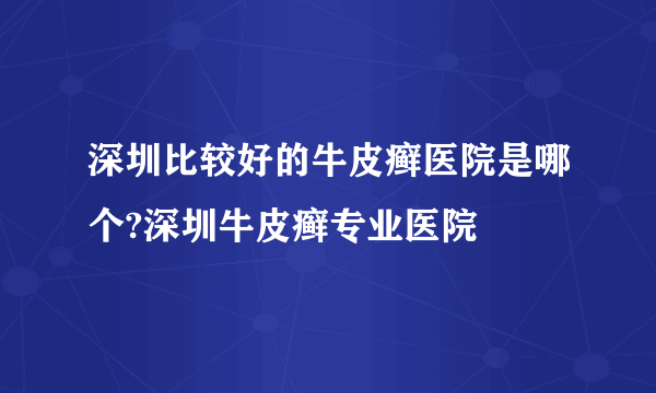 深圳比较好的牛皮癣医院是哪个?深圳牛皮癣专业医院