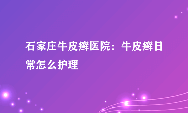 石家庄牛皮癣医院：牛皮癣日常怎么护理