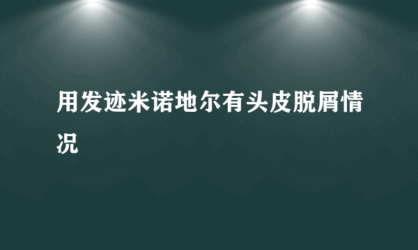 用发迹米诺地尔有头皮脱屑情况