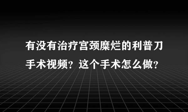 有没有治疗宫颈糜烂的利普刀手术视频？这个手术怎么做？