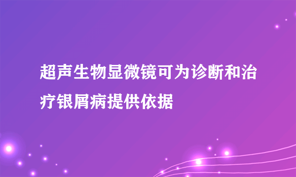 超声生物显微镜可为诊断和治疗银屑病提供依据