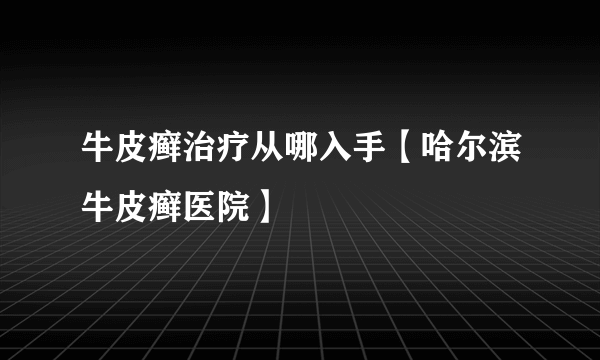 牛皮癣治疗从哪入手【哈尔滨牛皮癣医院】