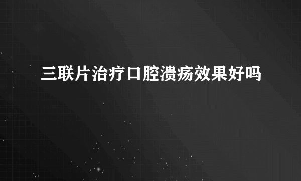 三联片治疗口腔溃疡效果好吗