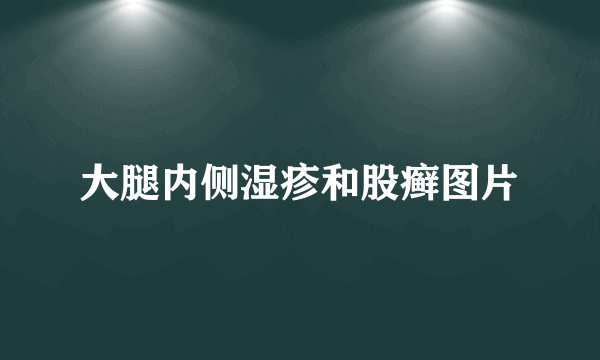 大腿内侧湿疹和股癣图片